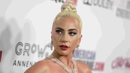 Lady Gaga, amerikanischer Pop-Star, hat Angst um ihre Bulldogen.