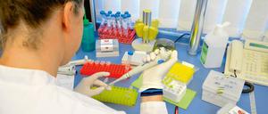 Eine junge Wissenschaftlerin hantiert in einem medizinischen Labor mit einer Pipette.