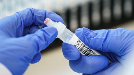 Die zuerst in Großbritannien aufgetretene Mutation B.1.1.7 ist ansteckender, als die Stammvariante des Virus.