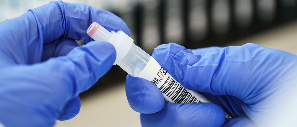 Die zuerst in Großbritannien aufgetretene Mutation B.1.1.7 ist ansteckender, als die Stammvariante des Virus.