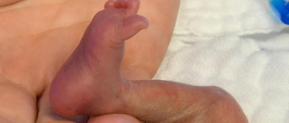 In der Hand einer Pflegekraft liegt der rechte Fuß eines fünf Tage alten Jungen.