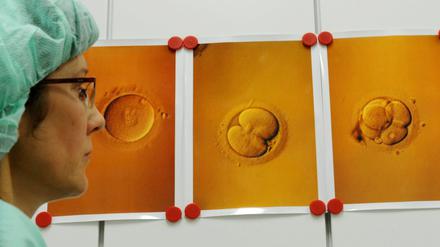In der Universitätsfrauenklinik in Leipzig hängen Abbildungen von Eizellen mit Spermien nach einer künstlichen Befruchtung. 