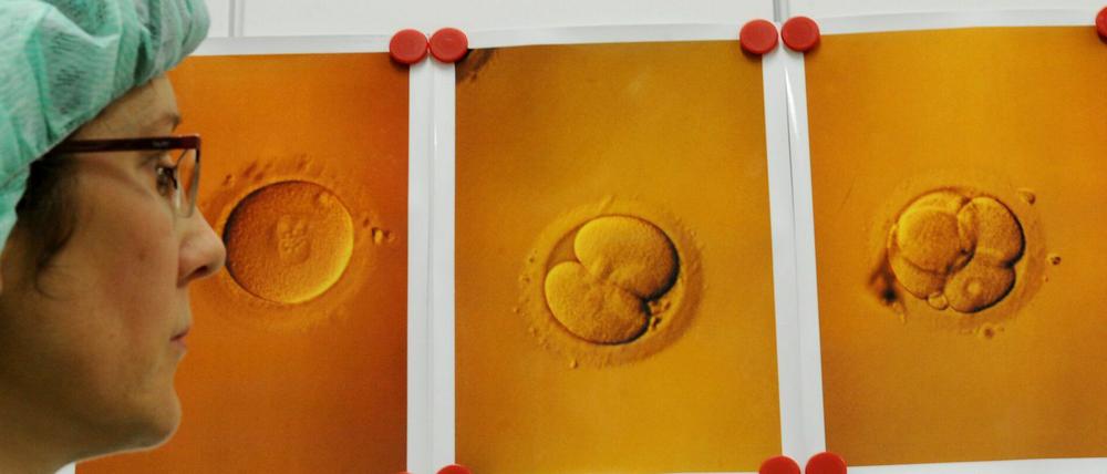 In der Universitätsfrauenklinik in Leipzig hängen Abbildungen von Eizellen mit Spermien nach einer künstlichen Befruchtung.