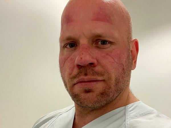 Lange nach einer Acht-Stunden-Schicht unter Maske und Visier.
