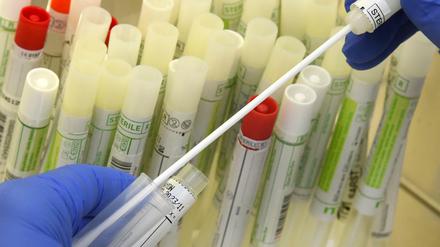 In einem PCR-Labor bereitet die Leiterin an der Sicherheitswerkbank Abstrichtupfer von Patienten für die SARS-CoV-2-Diagnostik vor.