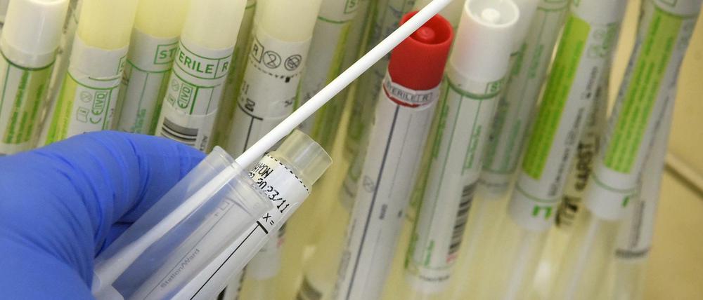In einem PCR-Labor bereitet die Leiterin an der Sicherheitswerkbank Abstrichtupfer von Patienten für die SARS-CoV-2-Diagnostik vor.