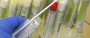 In einem PCR-Labor bereitet die Leiterin an der Sicherheitswerkbank Abstrichtupfer von Patienten für die SARS-CoV-2-Diagnostik vor. 
