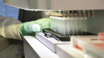 Ein Forscher arbeitet an der Entwicklung des Medikaments Aducanumab.