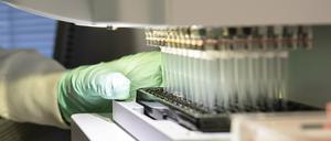 Ein Forscher arbeitet an der Entwicklung des Medikaments Aducanumab.