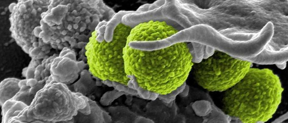 Das am National Institute of Allergy and Infectious Diseases in den USA erstellte Bild zeigt grün gefärbte MRSA-Bakterien, umhüllt von weißen Blutkörperchen.