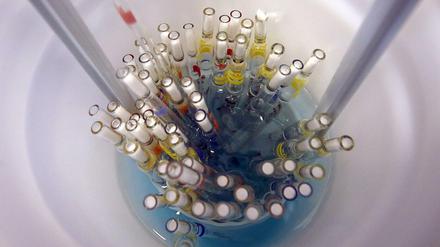 Grundlagenforschung ist oft unspektakulär, aber unentbehrlich. Benutzte Pipetten in einem Behälter im Max-Planck-Institut für Infektionsbiologie.