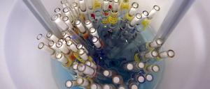 Grundlagenforschung ist oft unspektakulär, aber unentbehrlich. Benutzte Pipetten in einem Behälter im Max-Planck-Institut für Infektionsbiologie.