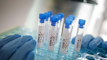 Das Robert Koch-Institut warnt vor einer erneuten raschen Ausbreitung des Virus.