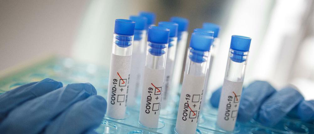 Das Robert Koch-Institut warnt vor einer erneuten raschen Ausbreitung des Virus.