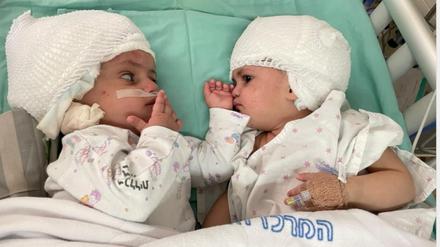 Die beiden Mädchen können sich zum ersten Mal anschauen.