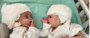 Die beiden Mädchen können sich zum ersten Mal anschauen.