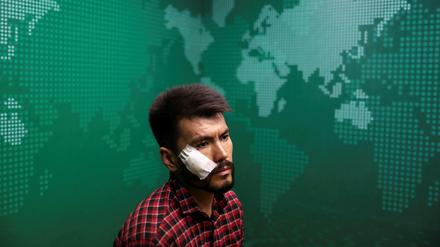 Ein von den Taliban geschlagener Journalist in Kabul