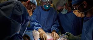 Einem US-Chirurgenteam ist laut Berichten der New York Times die Transplantation einer Schweineniere gelungen.