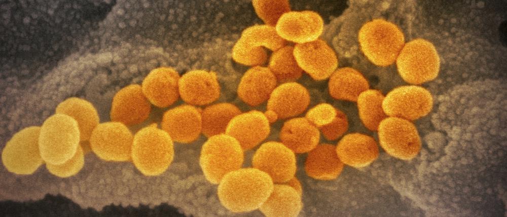 Eine elektronenmikroskopische Aufnahme zeigt das neuartige Coronavirus (Archivfoto).