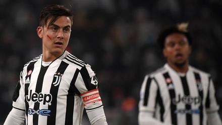 Mit roter Farbe im Gesicht machten Profifußballer wie Paulo Dybala von Juventus Turin auf Gewalt gegen Frauen aufmerksam.
