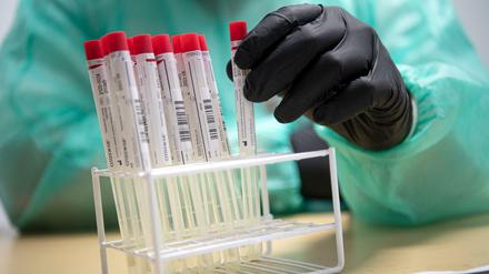 Testkits sind in einigen Bundesländern schon Mangelware. Ein Grund, warum die Fallzahlen nicht reliabel sein müssen.