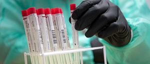 Testkits sind in einigen Bundesländern schon Mangelware. Ein Grund, warum die Fallzahlen nicht reliabel sein müssen.