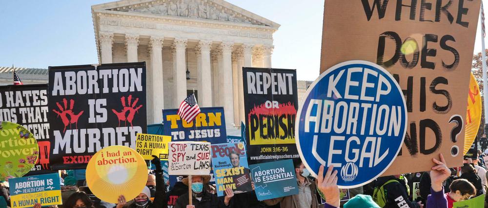 Die Debatte über Schwangerschaftsabbrüche spaltet die USA.