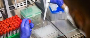 Neue Laborstudien und Ergebnisse aus Südafrika deuten auf milde Krankheitsverläufe bei Omikron-Infizierten hin.