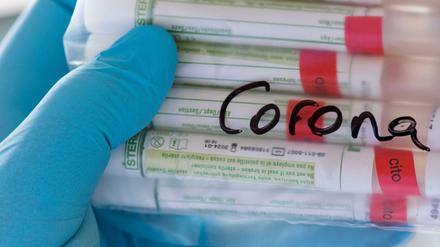 Proben für Corona-Tests werden für die weitere Untersuchung vorbereitet.