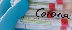 Proben für Corona-Tests werden für die weitere Untersuchung vorbereitet.