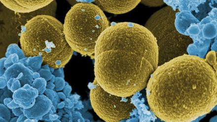 Staphylococcus aureus (gelb) ist ein Bakterium, das etwa auf der menschlichen Haut vorkommt. Einige Stämme sind gegen Antibiotika resistent geworden. Immunzellen (blau) können sie aber noch bekämpfen. Elektronenmikroskopische Aufnahme, angefärbt.