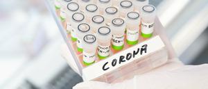 Eine biologisch-technische Assistentin zeigt aufbereitete PCR-Tests auf das Corona-Virus von Patienten im PCR-Labor.