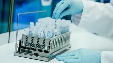 Ein Mitarbeiter hält in einem Coronatest-Labor PCR-Teströhrchen in den Händen.