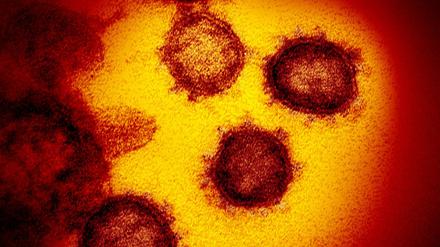 Die vom National Institute of Allergy and Infectious Diseases zur Verfügung gestellte Elektronenmikroskopaufnahme zeigt das Coronavirus SARS-CoV-2.