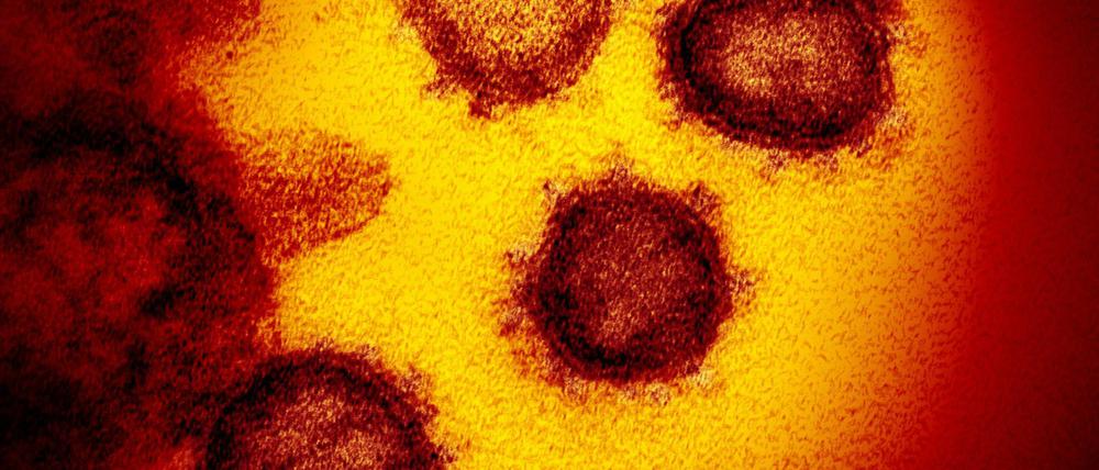 Eine Elektronenmikroskopaufnahme zeigt das Coronavirus SARS-CoV-2.