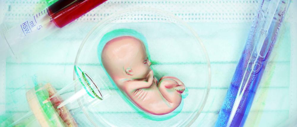 Welche Entscheidungen erzwingt die Pränataldiagnostik? Fötus-Figur in einer Petrischale (Symbolfoto),