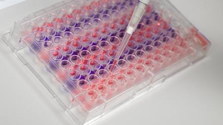 Europaweit wird nun nach der Ursache der Hepatitis-Fälle gesucht.