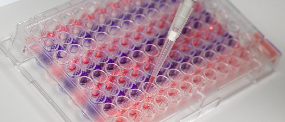Europaweit wird nun nach der Ursache der Hepatitis-Fälle gesucht.