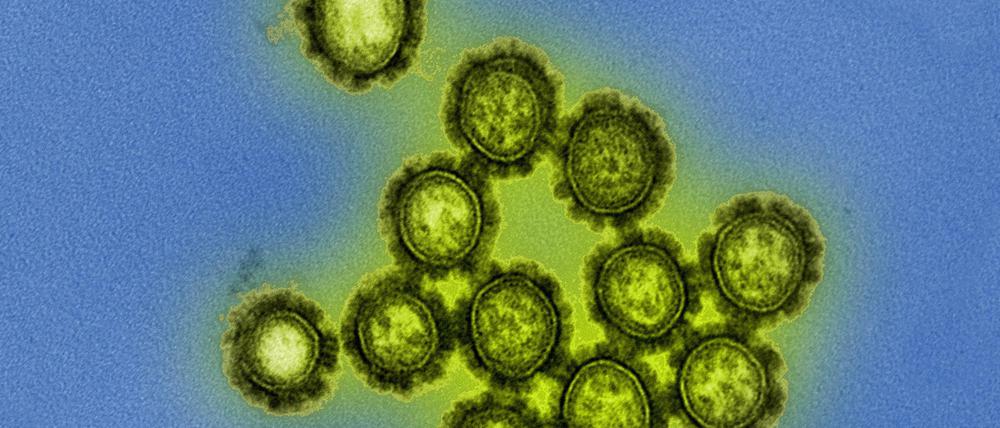 H1N1-Viren gehören zu einem der heute weltweit verbreiteten Stämmen von Grippe-erregenden Influanzaviren.