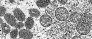 Diese elektronenmikroskopische Aufnahme aus dem Jahr 2003, die von den Centers for Disease Control and Prevention zur Verfügung gestellt wurde, zeigt reife, ovale Affenpockenviren (l) und kugelförmige unreife Virionen (r), die aus einer menschlichen Hautprobe im Zusammenhang mit dem Präriehundeausbruch von 2003 stammt. 