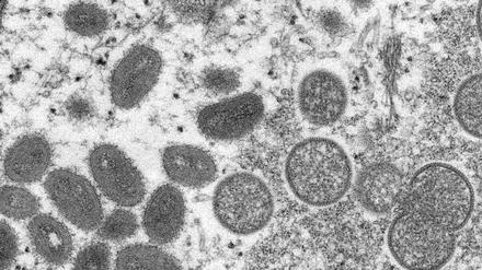 Elektronenmikroskopische Aufnahme des Centers for Disease Control and Prevention zeigt reife, ovale Affenpockenviren (l) und kugelförmige unreife Virionen (r).
