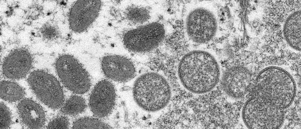 Das Virus kann unabhängig von sexueller Orientierung, Geschlecht und Alter übertragen werden.