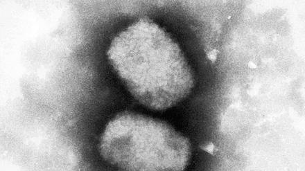Über das Affenpocken-Virus weiß die Forschung noch wenig.