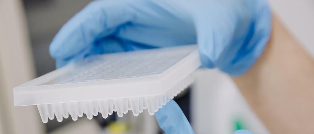 PCR-Test zur Erkennung des Affenpockenvirus: 18 Fälle der Viruserkrankung sind für Berlin inzwischen bestätigt.