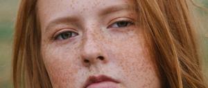 Diese Sommersprossen sind sichtbar nicht aufgemalt.