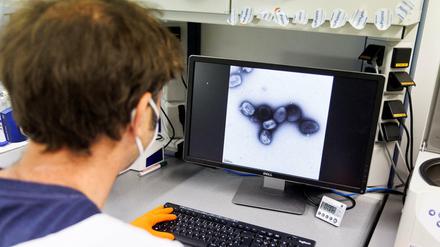 Ein Mitarbeiter eines bayerischen Impfstoffunternehmens für Affenpocken in seinem Labor (Archivbild). 