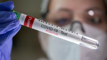 Mit steigenden Corona-Fallzahlen kommen auch immer mehr Long-Covid-Fälle dazu. In Berlin könnten es bis zu 75 000 Erkrankte sein.
