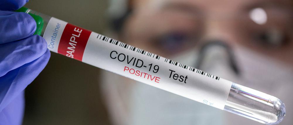 Mit steigenden Corona-Fallzahlen kommen auch immer mehr Long-Covid-Fälle dazu. In Berlin könnten es bis zu 75 000 Erkrankte sein.