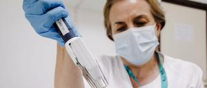 Eine Krankenschwester bereitet in einem Krankenhaus einen PCR-Tests zur Erkennung des Affenpockenvirus vor. 