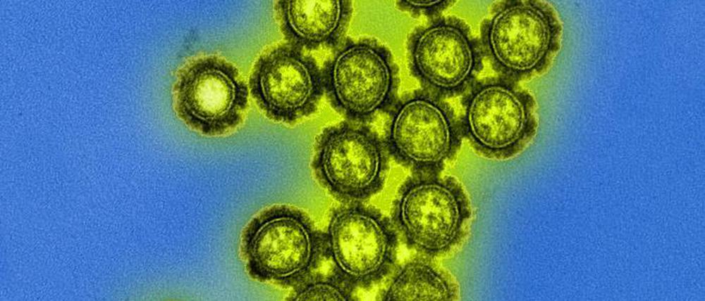 Influenza-Viren nutzen Proteine auf der Oberfläche (schwarz), um Zellen der Atemwege zu infizieren.